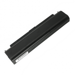 China Factory Supply 45N1146 Laptop Battery For Lenovo ThinkPad T440P T540P W540 W541 L440 L540 Seies